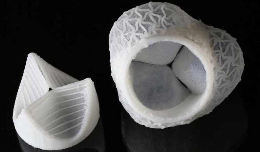 válvulas cardiácas impresas en 3D