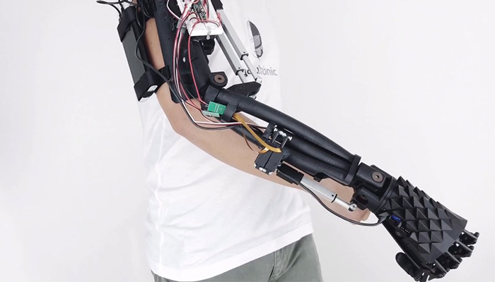 bionic arm