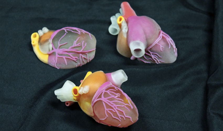 modelos quirúrgicos 3D