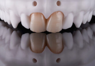 Pressinger Dental Solutions