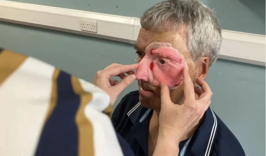 prótesis facial 3D