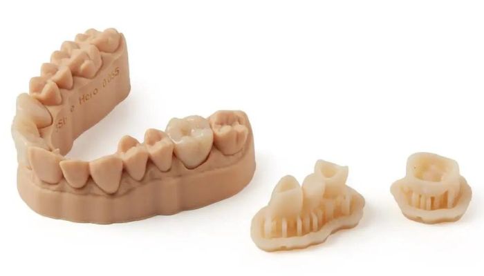 stampa 3D dentale