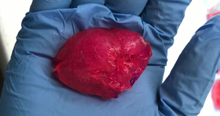 corazón humano bioimpreso