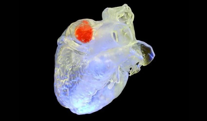 impresión 3D dentro del cuerpo humano