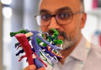 modelos tumorales impresos en 3D