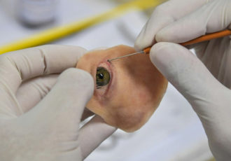 Prótesis facial