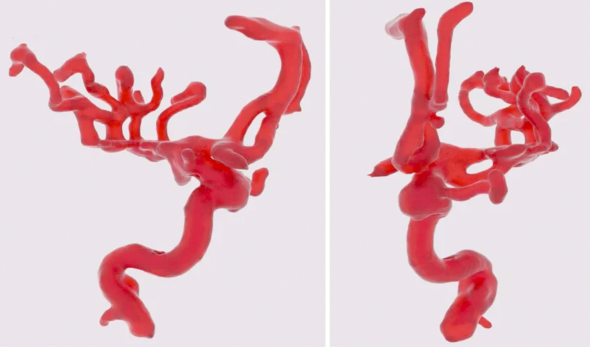 vasos sanguíneos impresión 3D