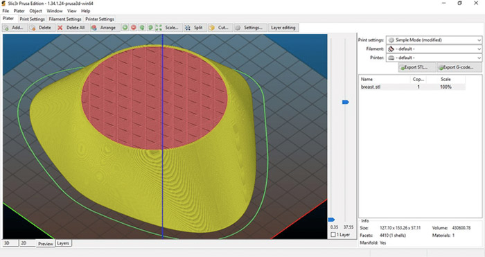 Slicer 3D