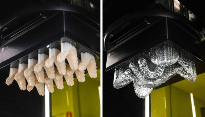 stampa 3D dentale