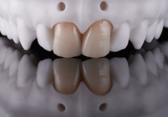 Pressinger Dental Solutions