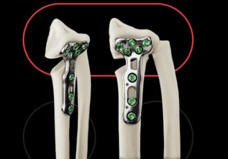 TailorSurgery