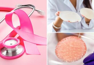cancro seno stampa 3d