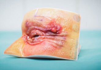 Occhi stampati in 3D Addion