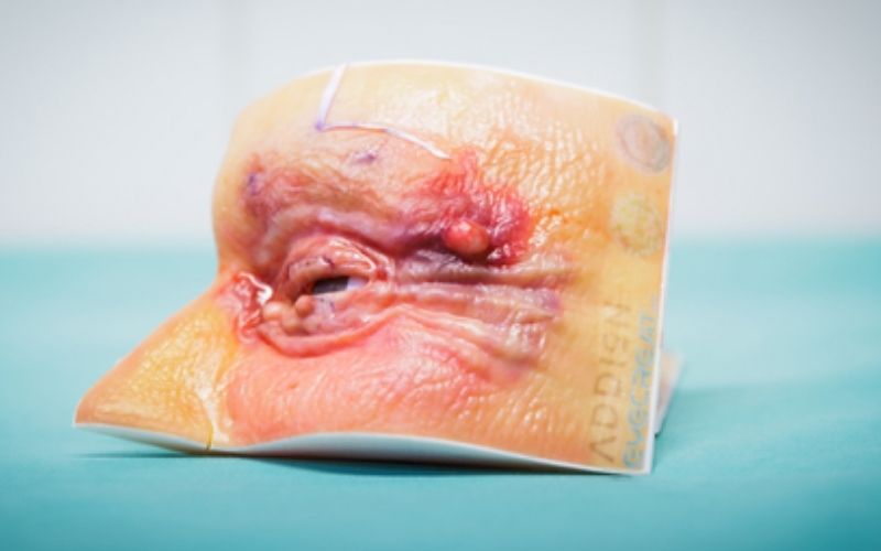 Occhi stampati in 3D Addion