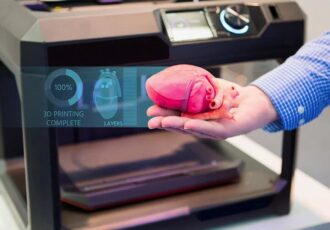 impression 3D médicale