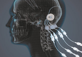 implant administration medicament 3D