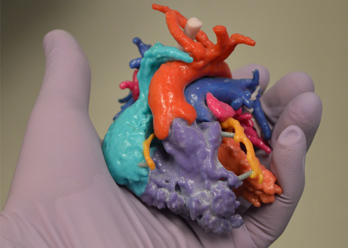 3D-gedruckte chirurgische Modelle