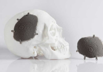 implant 3D