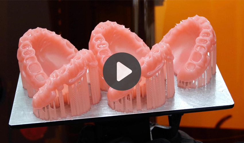 impression 3D modèles dentaires