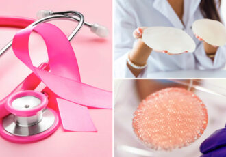 cancer du sein impression 3D