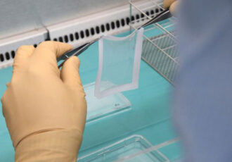 bio-impression hôpital