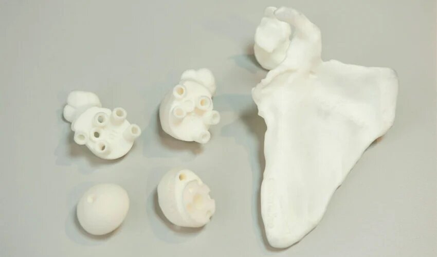 impression 3D planification chirurgicale