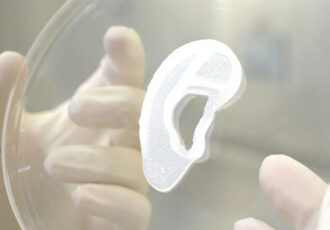 oreille imprimée en 3D