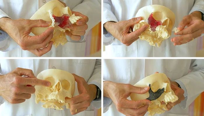 impression 3D hopital