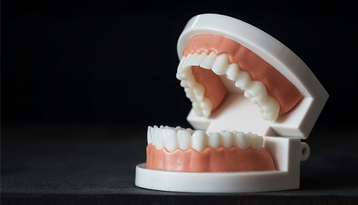 application impression 3D dentaire