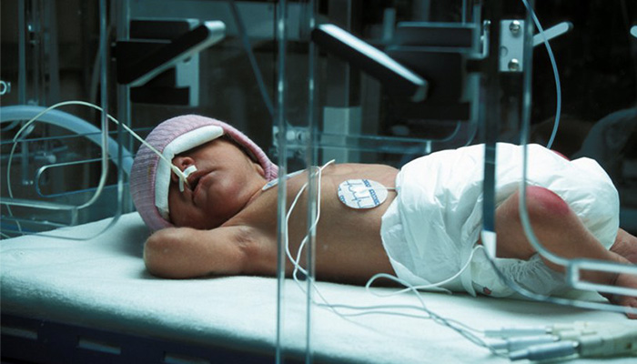 premature baby 3D printing