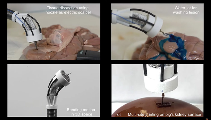 3D Bioprinting