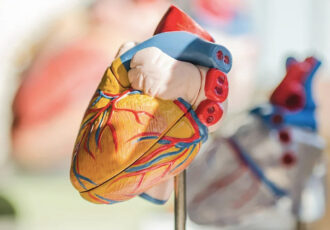 Cardiopatch