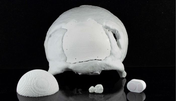 Hydroxyapatite is a technical bioceramic that can also be used with additive manufacturing
