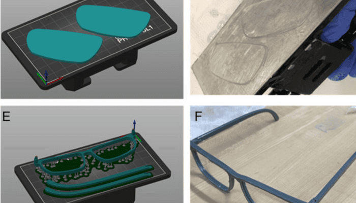 Impression 3D ophtalmologie