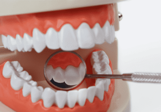 restauration dentaire
