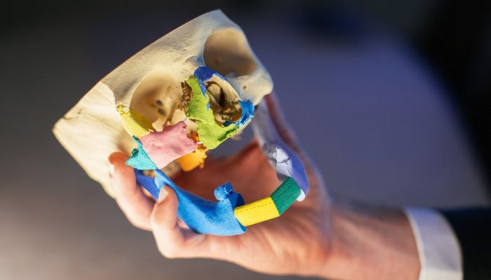 impression 3D hôpitaux