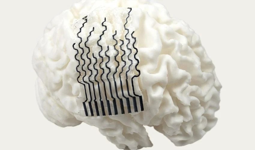 électrodes imprimées en 3D