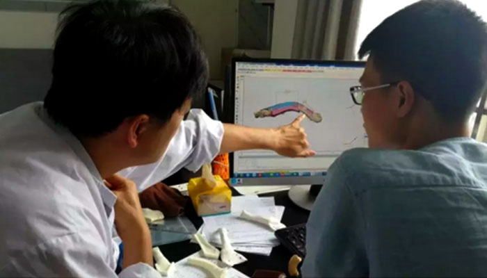 implant imprimé en 3D