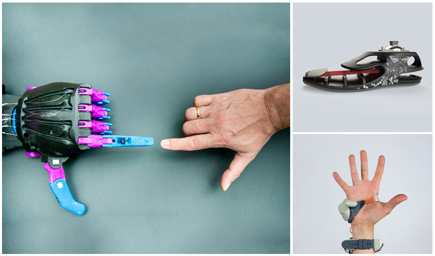prothèses imprimées en 3D