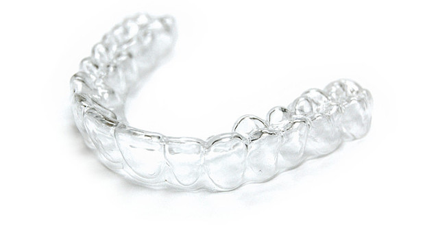 Une gouttière Invisalign réalisée via un moule imprimé en 3D