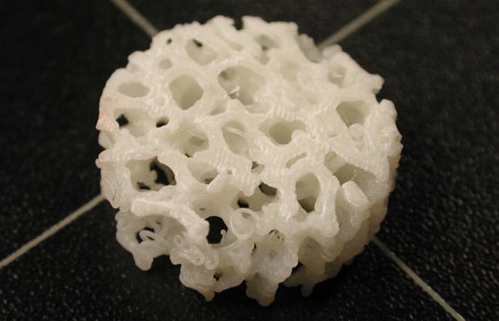 implants osseux imprimés en 3D