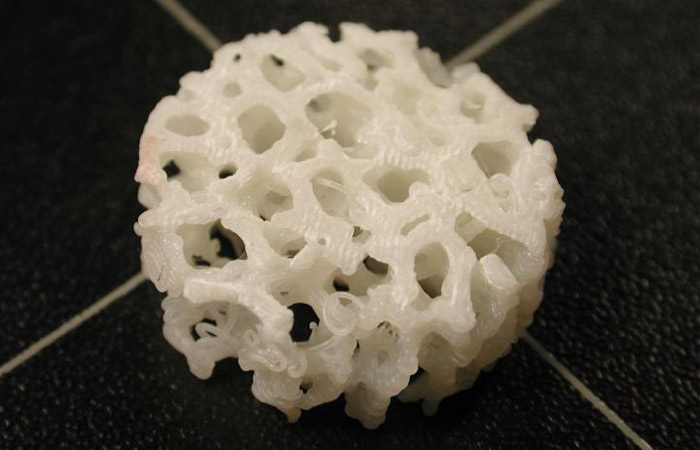 3D printed bone implants