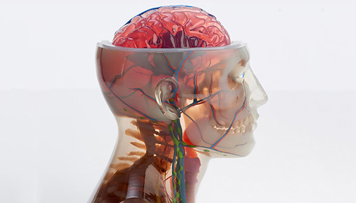 impression 3D par jet de matière
