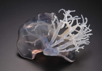 fabrication additive médicale