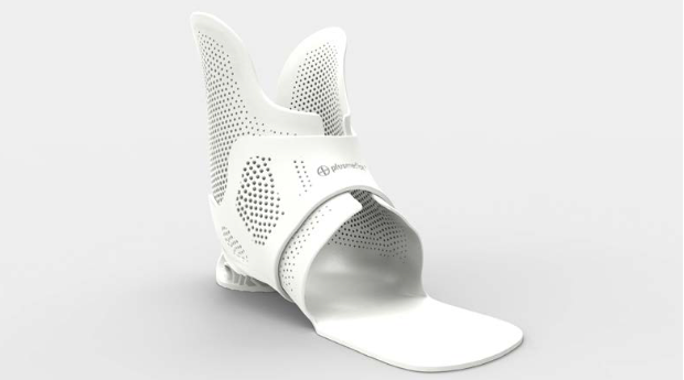 orthèse imprimée en 3D