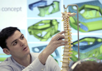 renishaw implants