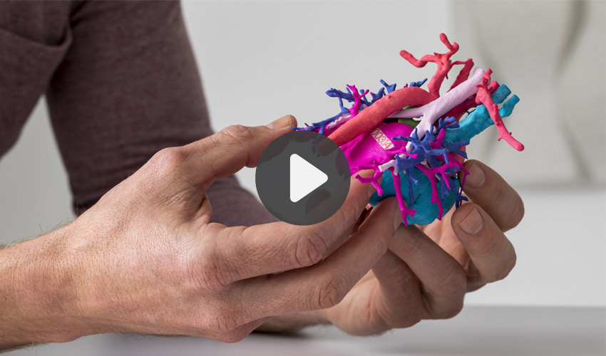 imprimante 3D hôpital